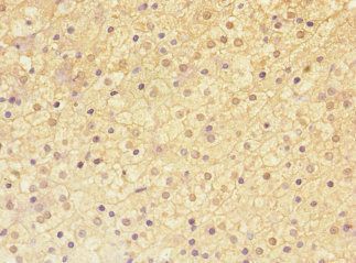 ADAMTSL4 antibody