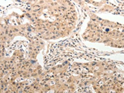 ADAR Antibody