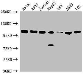 ADAR antibody