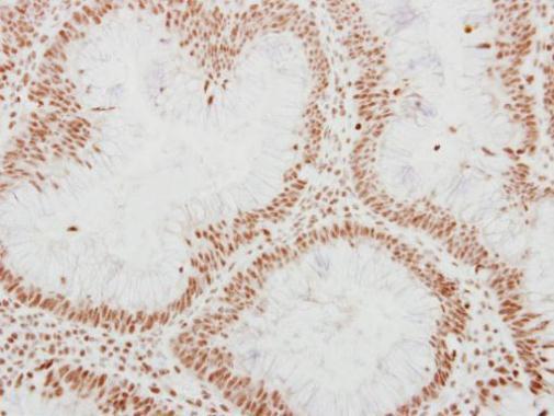 ADAR1 antibody [N3C1], Internal