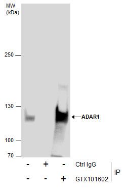 ADAR1 antibody