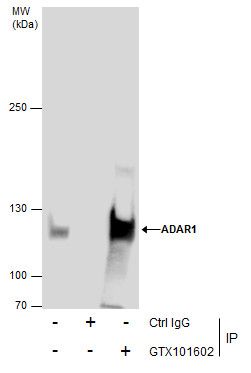 ADAR1 antibody [N3C1], Internal