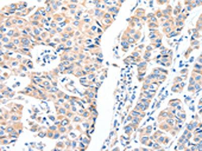ADCK1 Antibody
