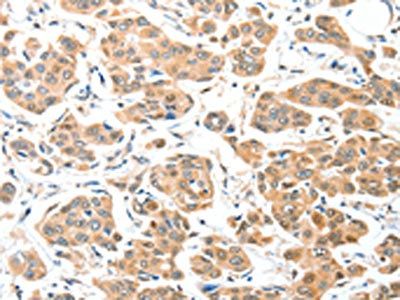 ADCK1 Antibody