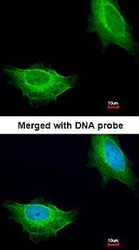 ADCK1 antibody