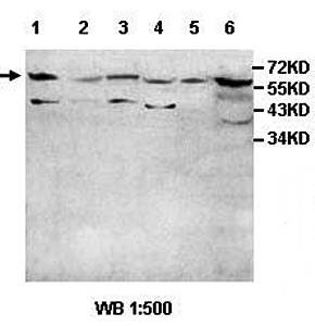 ADCK1 Rabbit Polyclonal Antibody