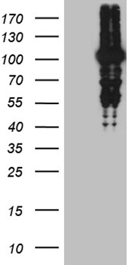 ADCK3 Antibody