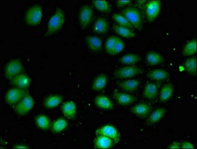 COQ8B Antibody