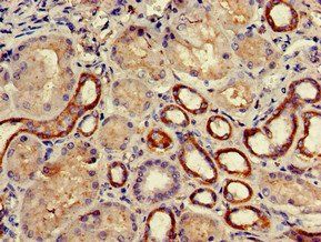 COQ8B Antibody