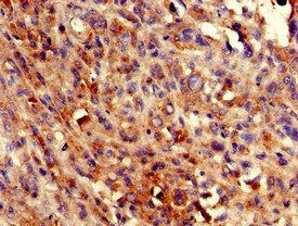 COQ8B Antibody