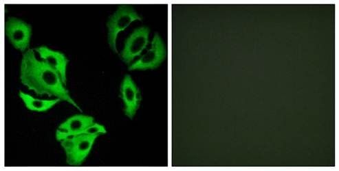 ADCK4 Antibody