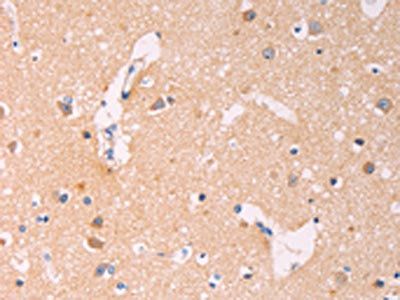 ADCY1 Antibody