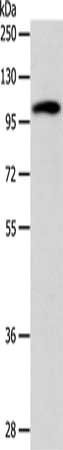 ADCY1 Antibody