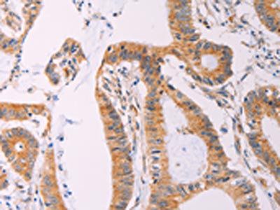 ADCY1 Antibody