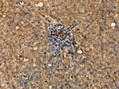 ADCY3 Antibody