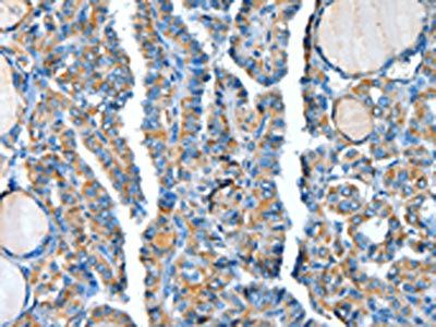 ADCY4 antibody