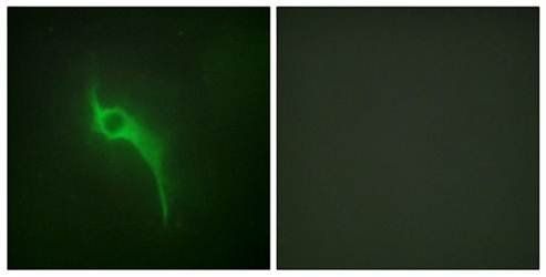Collagen V α1 Antibody