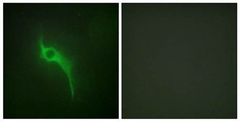 ADCY5/6 antibody