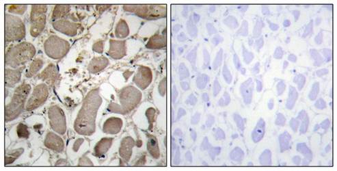 Collagen V α1 Antibody