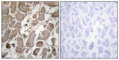 ADCY5/6 antibody