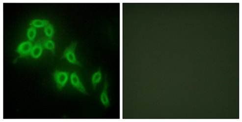Collagen V α2 Antibody