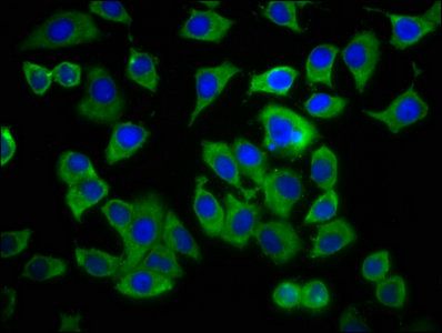 ADCY8 Antibody