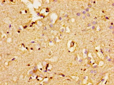 ADCY8 Antibody