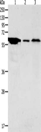 ADCYAP1R1 antibody