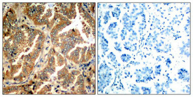 ADD1 (Ab-726) Antibody