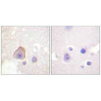 ADD1 (Ab-726) Antibody