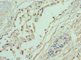 ADD1 Antibody
