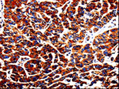 ADD1 Antibody