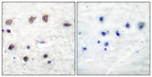 ADD1 (Phospho-Ser726) Antibody