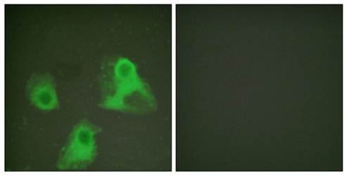 ADD1 (Phospho-Ser726) Antibody