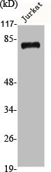 ADD2 Antibody