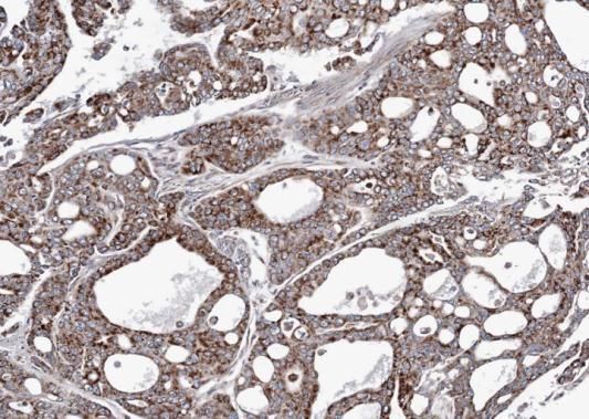 Adenylate kinase 4 antibody [N1C3]
