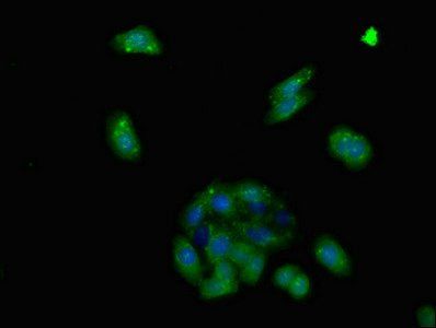 ADGRA2 antibody