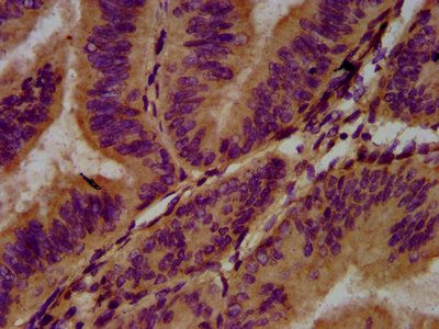 ADGRG1 Antibody