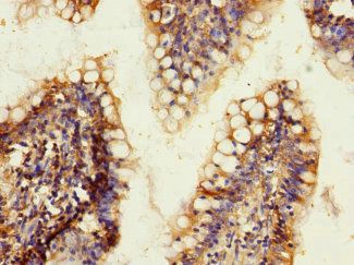 ADGRL2 Antibody