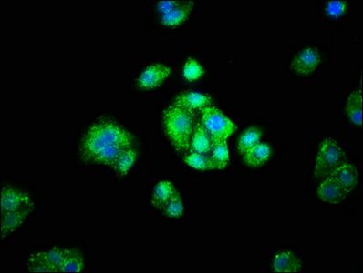 ADH1A antibody