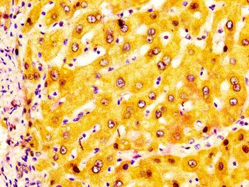 ADH1A Antibody