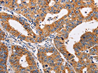 ADH1A Antibody