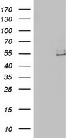 ADH1B Antibody