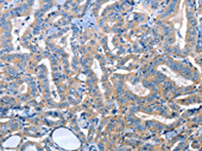 ADH4 Antibody