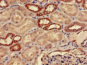 ADH5 antibody