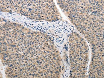 ADHFE1 Antibody