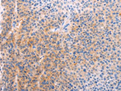 ADHFE1 Antibody