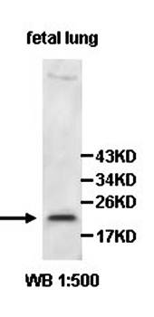 ADI1 Rabbit Polyclonal Antibody