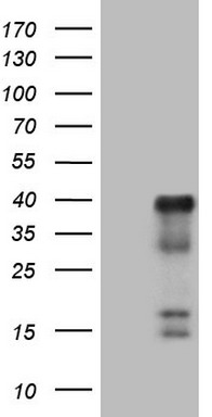 Adiponectin Antibody