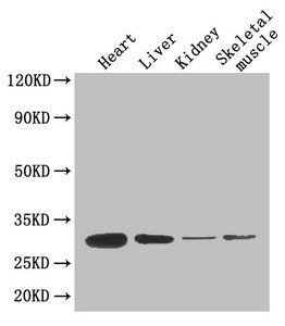 Adiponectin antibody